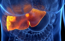 10 nguyên nhân không ngờ gây suy gan cấp: Số 3 nhiều người dễ mắc