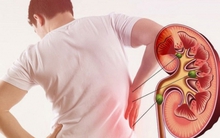 Suy thận ở thanh thiếu niên và dấu hiệu cảnh báo sớm