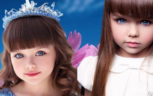 Bé gái từng gây sốt với khuôn mặt đẹp như búp bê bây giờ thế nào?