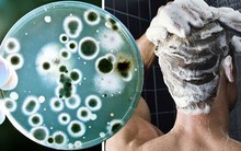 Bác sĩ cảnh báo: Không vệ sinh thứ này trong phòng tắm đúng cách có thể gây tổn thương da, phổi