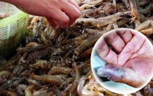 Trung Quốc: Rửa tôm bị đâm vào tay, người đàn ông tử vong vì suy đa tạng sau 3 ngày