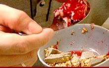 Người đàn ông suy đa tạng sau khi ăn món nhiều người yêu thích