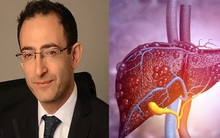 Bác sĩ gan liệt kê 6 dấu hiệu của gan nhiễm mỡ - căn bệnh diễn biến vô cùng thầm lặng