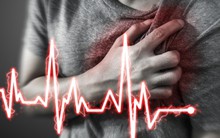 Nghiên cứu tiết lộ sai lầm nhỏ khi ăn có thể gián tiếp đẩy nguy cơ đột quỵ cao hơn gấp 5 lần