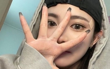 Nếu thận bị tổn thương, chân và tay sẽ phát ra 4 cảnh báo