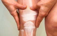 6 dấu hiệu trên cơ thể cảnh báo ung thư xương đã “gõ cửa”: Người trẻ càng phải đề phòng