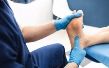 Nhìn chân đoán bệnh: 6 dấu hiệu ở bàn chân có thể cảnh báo bệnh tật mà bạn không biết