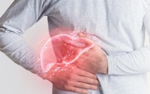 Thói quen ăn uống làm hỏng gan mật nhiều người Việt đang mắc