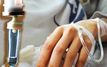 Ung thư đại tràng giai đoạn sớm rất ít triệu chứng, nhưng sau đó có thể xuất hiện 4 dấu hiệu