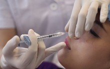 Cô gái 17 tuổi mù một bên mắt, có nguy cơ liệt nửa mặt sau khi làm mũi: BS lưu ý 2 điều khi làm đẹp