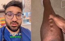 Bác sĩ cấp cứu: Ấn vào chân mà thấy hiện tượng này thì rất có thể tim, gan, thận đang 'kêu cứu'