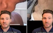 Bác sĩ cấp cứu: Nếu thấy dấu hiệu này ở cổ, hãy đi khám ngay vì tim mạch có thể đang gặp nguy