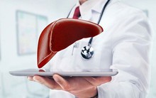 Bệnh gan 'tránh xa' nếu bạn biết làm 7 điều cực đơn giản này: 3 chuyên gia hàng đầu chỉ cách