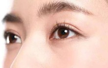 'Tín hiệu' xuất hiện trên lông mày có thể cảnh báo bệnh nghiêm trọng
