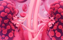 Cơ thể xuất hiện 6 dấu hiệu này, coi chừng thận đang 'kêu cứu'