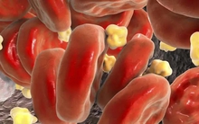 Mạch máu quyết định tuổi thọ: Mỗi ngày đều đặn làm 3 việc, mạch máu sẽ dần “trẻ hóa” và tránh bệnh tật