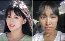 Bức ảnh chụp cận gương mặt của Lý Tử Thất gây hoang mang: "Tôi phải đến bệnh viện tiêm thuốc"