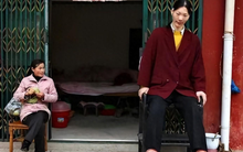 Cuộc đời 41 năm kỳ lạ của cô gái khổng lồ, cao 2,36 mét: suýt trở thành vận động viên bóng rổ, cuối đời chịu đau đớn vì 1 căn bệnh hiếm gặp 