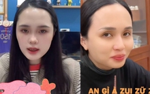 Ái nữ nhà cựu Chủ tịch CLB Sài Gòn tiết lộ từng thẩm mỹ gương mặt, nhan sắc chị gái đang mang bầu gây chú ý