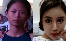 Cô gái nghiện làm đẹp từ năm 13 tuổi, chi 14 tỷ đồng để phẫu thuật thẩm mỹ, hiện tại hối hận nhưng đã muộn màng