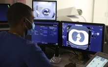 WHO dự đoán số ca mắc ung thư toàn cầu đến năm 2050 sẽ tăng hơn 75%