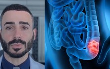 BS tiêu hóa tiết lộ 8 thực phẩm giúp phòng chống ung thư đại trực tràng, nhiều loại dễ kiếm ở Việt Nam