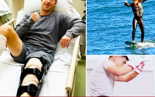 Sở thích thể thao mạo hiểm của Mark Zuckerberg có thể gây rủi ro đầu tư
