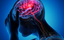 Hơn 1/3 dân số thế giới đối diện vấn đề thần kinh