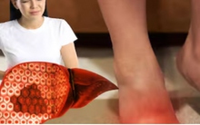 6 bộ phận trên cơ thể sưng tấy bất thường cảnh báo tổn thương gan nghiêm trọng