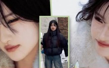 Bộ ảnh gây sốt mạng tạo bước ngoặt cuộc đời cho cô gái khuyết tật