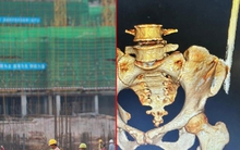Thêm 1 vụ tai nạn lao động ở công trường xây dựng, nữ công nhân bị thanh sắt rơi trúng, đâm xuyên người