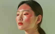 Dị ứng mọi loại kem chống nắng, cô gái trẻ cầu cứu bác sĩ, chỉ định điều trị được gói gọn trong 5 từ