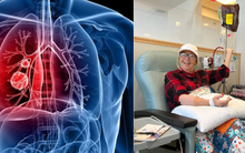 Mỹ phê duyệt thuốc điều trị ung thư phổi giá gần 20 tỷ đồng