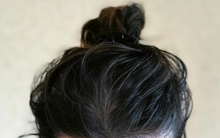 5 dấu hiệu chứng tỏ bạn chưa vệ sinh cơ thể đúng cách