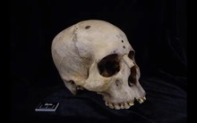 Người Ai Cập cách đây 4.000 năm đã biết điều trị ung thư như thế nào?