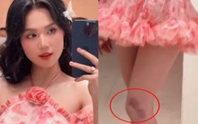 Vóc dáng hiện tại của Ngọc Trinh sau khi lộ khuyết điểm đáng báo động