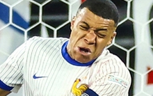 Siêu tiền đạo tuyển Pháp lần đầu lên tiếng sau chấn thương gãy mũi kinh hoàng, hàng triệu fan sôi sục