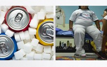 Kinh nghiệm đánh thuế đồ uống có đường của các quốc gia trên thế giới