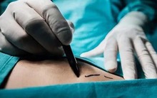 Báo Ukraine: Cựu Thứ trưởng Y tế đứng đầu đường dây đánh cắp nội tạng