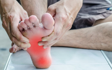 Ung thư phổi đến, chân sẽ có dấu hiệu: Thấy 3 điểm bất thường ở cả 2 chân, hãy chụp CT càng sớm càng tốt