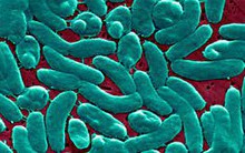 Người đàn ông nguy kịch do 'vi khuẩn ăn thịt người': Bác sĩ chỉ ra hành động làm tăng nguy cơ