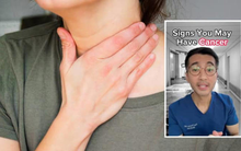 Bác sĩ chuyên khoa ung thư chia sẻ 5 triệu chứng phổ biến mà hầu hết mọi người bỏ qua