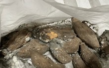 Ăn khoai lang kiểu này, cô gái 26 tuổi bàng hoàng nhận tin mắc ung thư gan