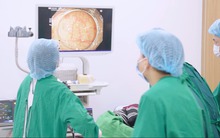 Gia đình 3 đời mắc ung thư đại tràng, người đàn ông Hà Nội phát hiện tổn thương sớm nhờ làm 1 điều