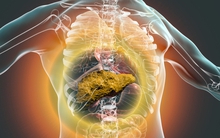 Khi bị bệnh gan, cơ thể sẽ xuất hiện "3 vàng, 1 đỏ", kiểm tra ngay xem gan của bạn có khoẻ mạnh không