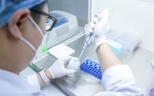 Một yếu tố quan trọng giúp bác sĩ ra quyết định điều trị, tránh bỏ lỡ “thời gian vàng”: Cần đảm bảo chất lượng xuyên suốt toàn bộ quy trình