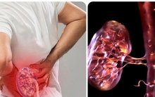 19 dấu hiệu thận yếu bạn không nên bỏ qua