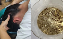 Lần đầu tiên sau 40 năm cuộc đời phát hiện: 9 sự "bá đạo" của giấm trắng