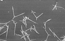 Gia tăng các ca viêm phổi do Mycoplasma, Nhật Bản cảnh báo nguy cơ bùng phát dịch