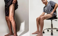 Tình trạng bất ổn của Khoa Pug